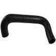 Massey Ferguson Radiator Hose